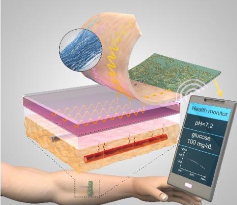 Threads penetrate multiple layers of tissue to sample interstitial fluid and direct it to sensing threads that collect data, such as pH and glucose levels. Conductive threads deliver the data to a flexible wireless transmitter sitting on top of the skin.